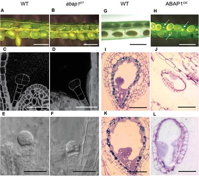 ABAP1 Plays a Role in the Differentiation of Male and Female Gametes in Arabidopsis thaliana